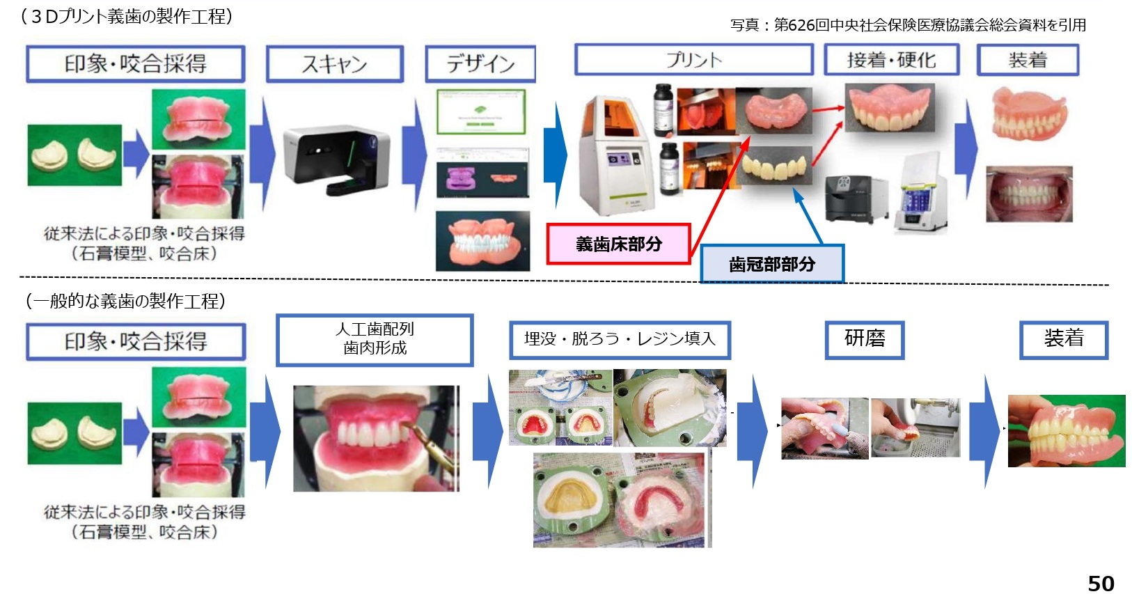 3次元プリント総義歯が保険適用になりました